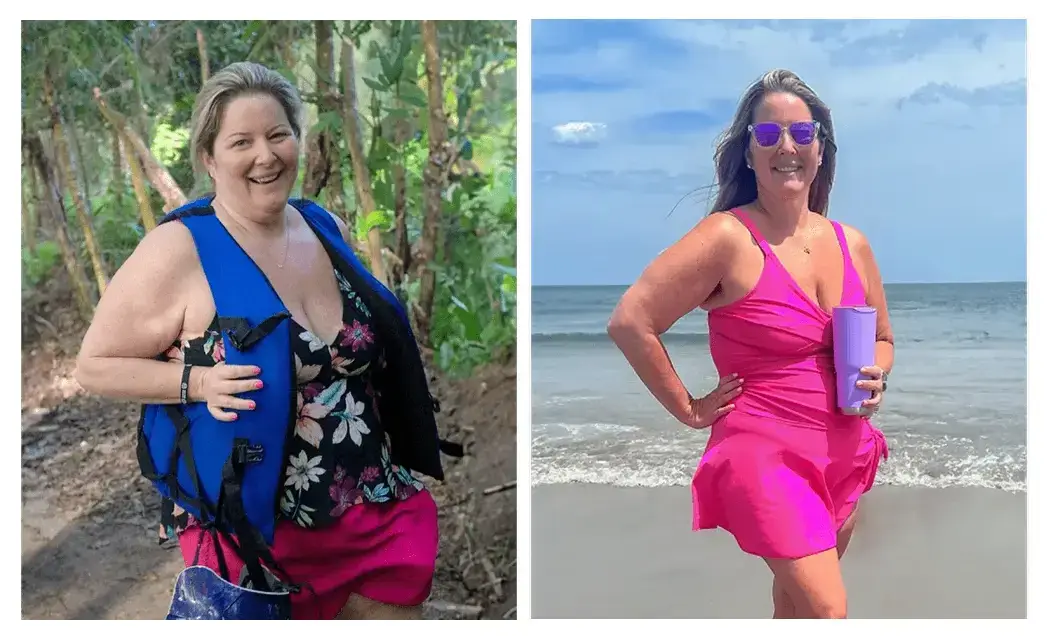 Before and After Photo